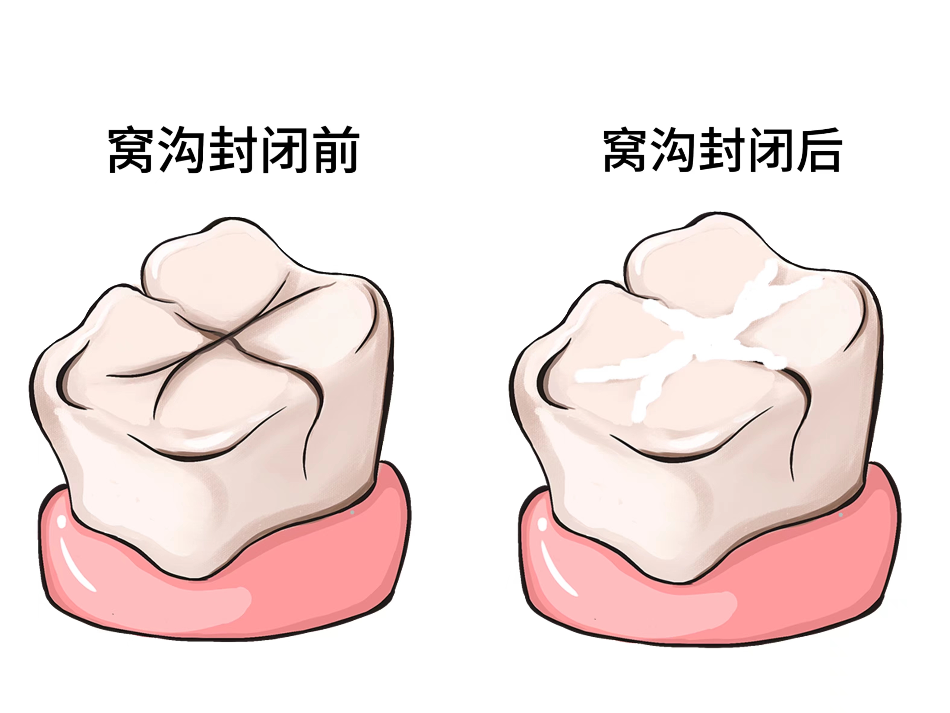 许昌看牙价格